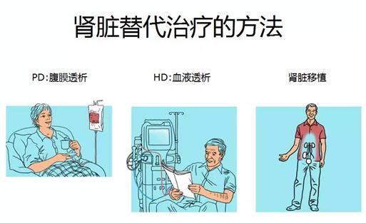 透析方法都有哪些